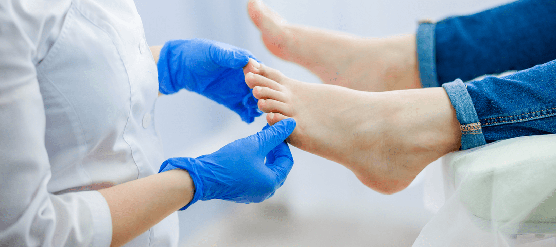 Olor de pies, a qué se debe y tratamientos - Vital Seguro
